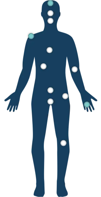Interactive body map showing symptoms across organs.