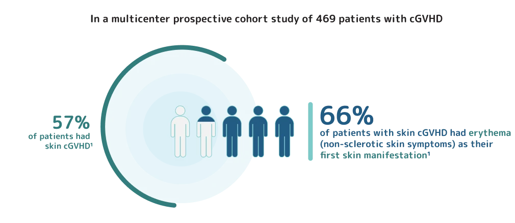 Infographic describing a study of 469 cGVHD patients, where 57% had skin cGVHD and 66% had cGVHD erythema (non-sclerotic skin symptoms) as their first skin manifestation.